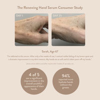Thumbnail for Renewing Hand Serum