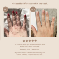 Thumbnail for Overnight Foot & Hand Hydration Mask